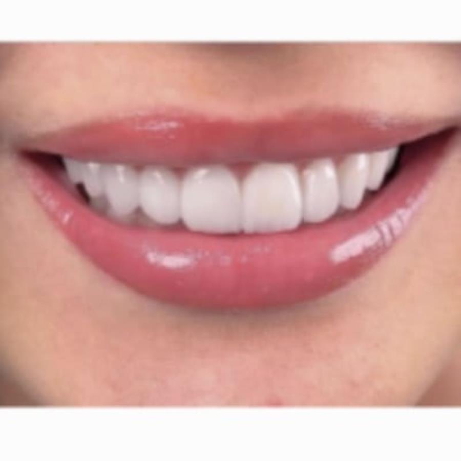 Kepce p eo aca  Eaepype